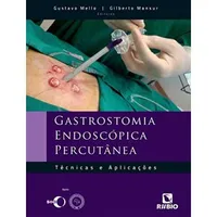 Gastrostomia Endoscópica Percutânea: Técnicas e Aplicações